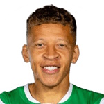 Dwight Gayle